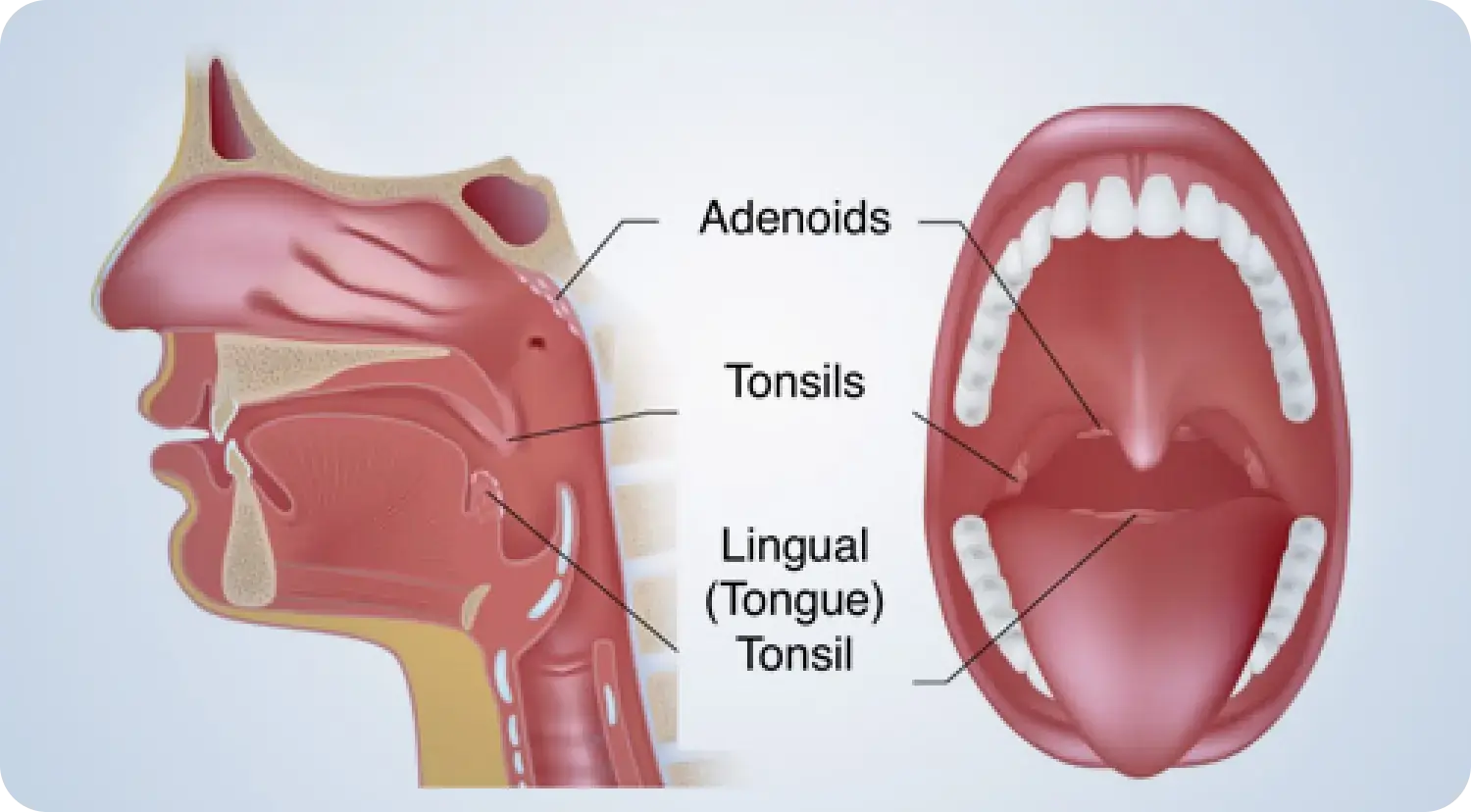 Adenoids Baddiehubpro.com